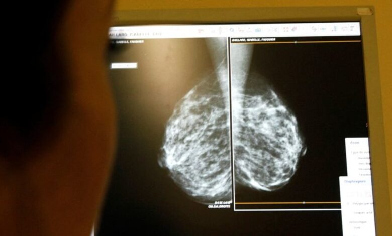 New breast cancer genes found in women of African ancestry, may improve risk assessment