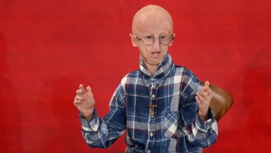 Survivor of rare rapid-ageing disease progeria dies at 28