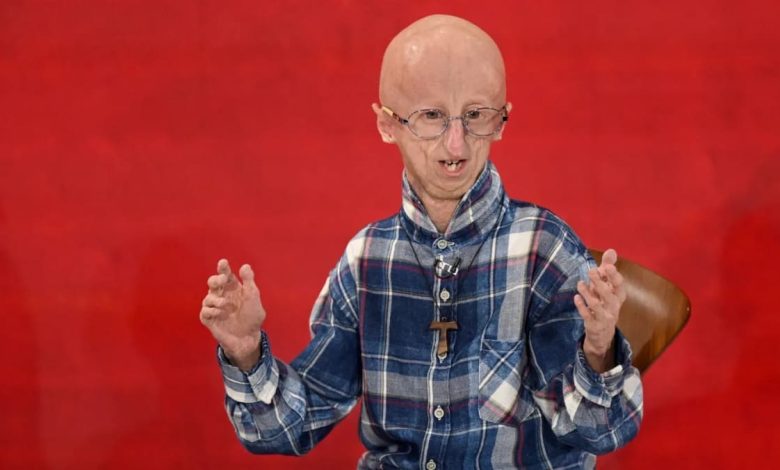 Survivor of rare rapid-ageing disease progeria dies at 28