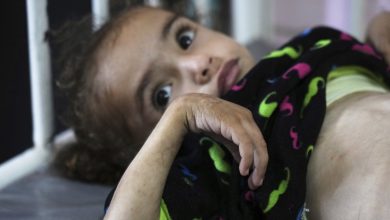 Gaza’s main hospital bursts at seams amid child malnutrition crisis