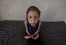 Trapped Gaza girl fights undiagnosed illness sans medicine, hope