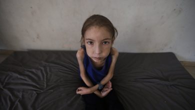 Trapped Gaza girl fights undiagnosed illness sans medicine, hope