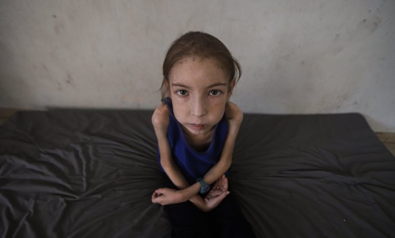 Trapped Gaza girl fights undiagnosed illness sans medicine, hope