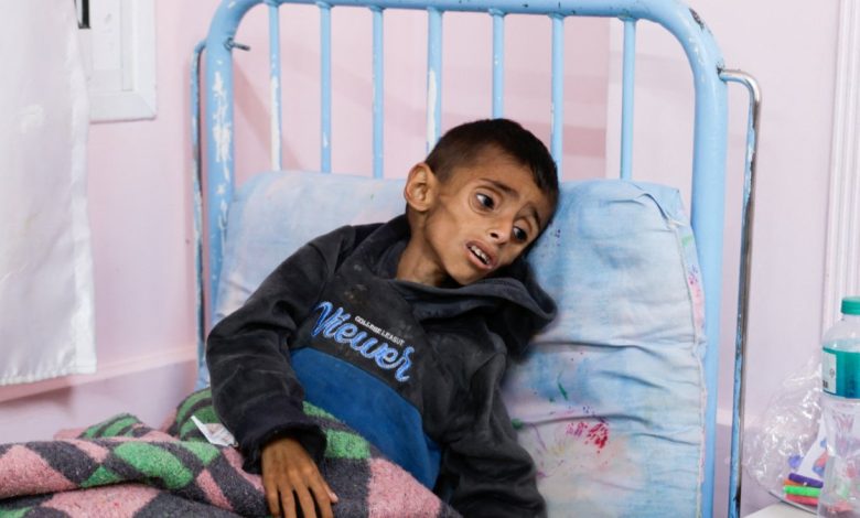 WHO warns of worsening Gaza health crisis amid 2-month aid blockade